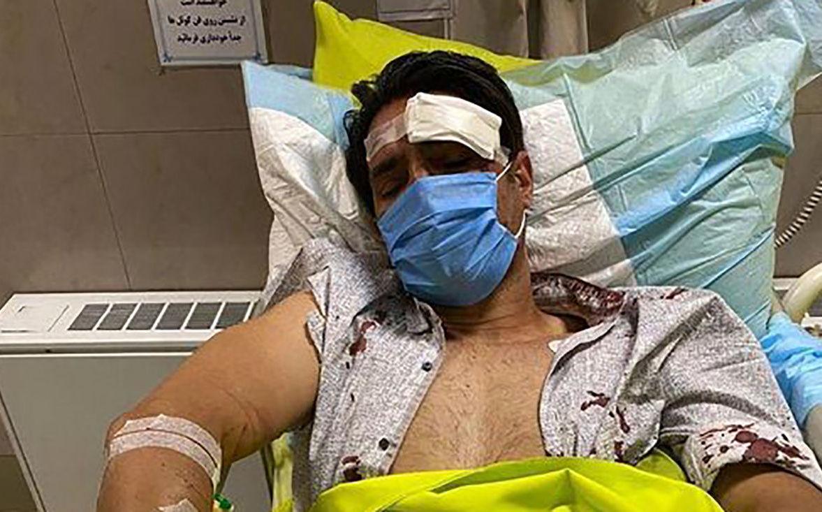 تصادف دلخراش فوتبالیست معروف با موتور و بستری وی در بیمارستان+عکس لورفته