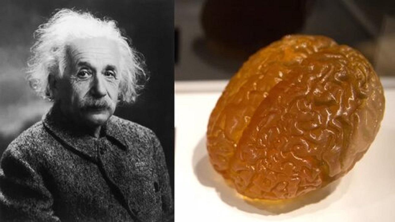 مغز اینشتین در کجا نگهداری می شود؟+ عکس