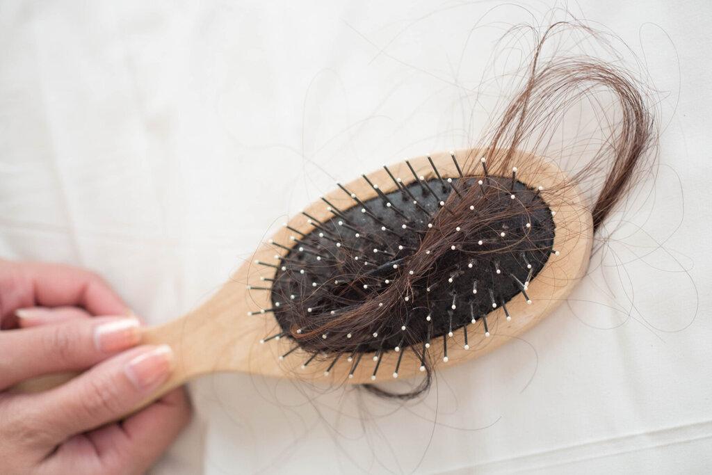 درمان چربی موی سر بدون شست‌وشو | چگونه چربی موی سر را از بین ببریم؟
