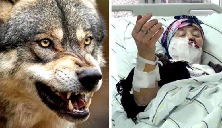 جنگ تن به تن مادر 6 فرزند با گرگ وحشی برای نجات جانش! +تصاویر دردناک
