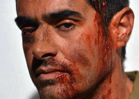 چهره کتک خورده و خونین شهاب حسینی+جزئیات