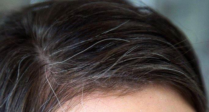 ترفند جلوگیری از سفید شدن مو | با رعایت این نکات از سفید شدن مو جلو گیری کنید