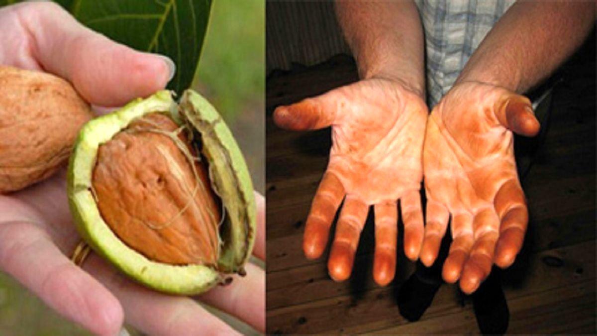 روش جادویی برای پاک کردن لکه گردو از روی دست | 6 روش برای از بین بردن لکه گردو از روی دست