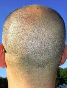 روش هایی استثنایی برای پرپشت کردن موی مردان در مدت کوتاه!